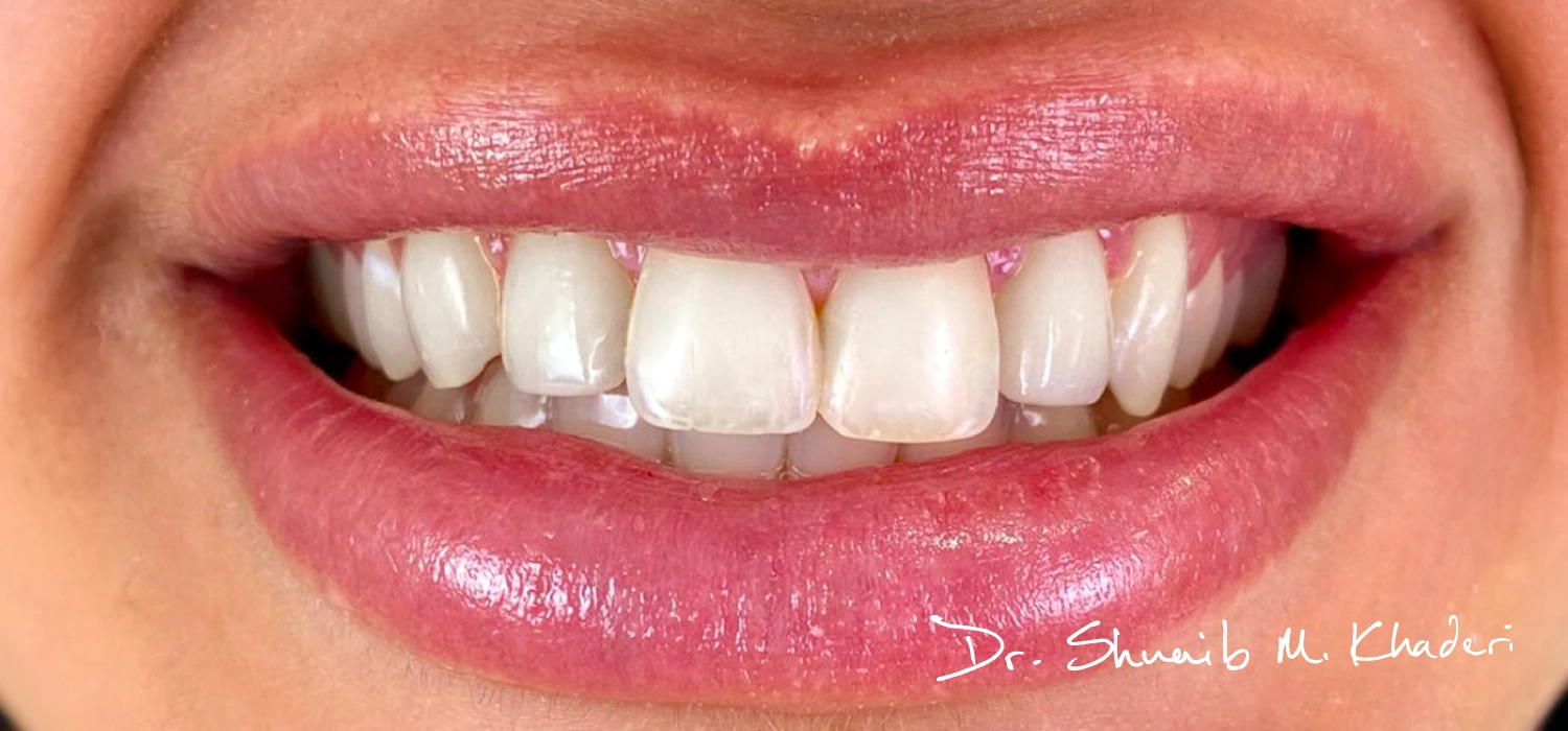 Questions To Ask Your Dentist During A Visit